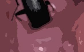 【エロ同人】私の蟲姦遊び 25話 妊娠中にベランダにいたゴミムシ編のトップ画像